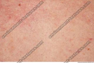 Photo Textures of Human Skin